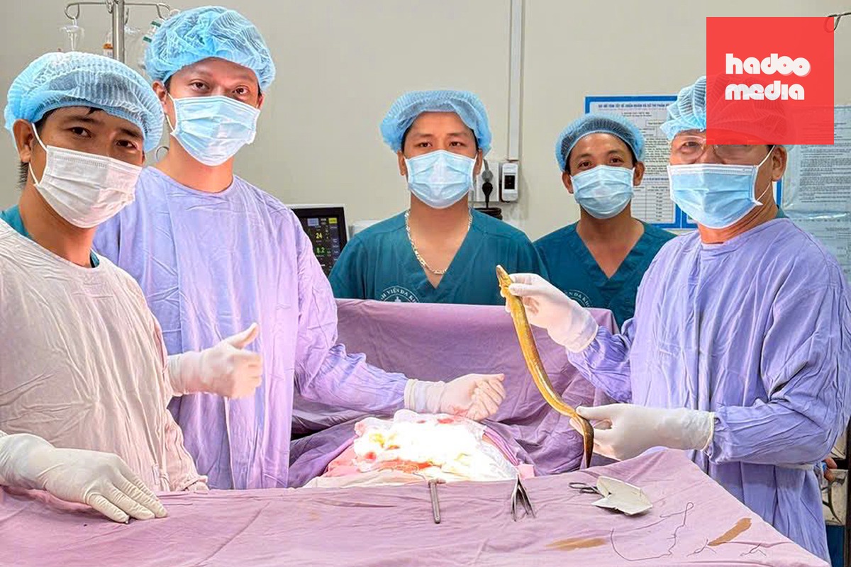 Y, bác sĩ Bệnh viện Đa khoa Thống Nhất Đồng Nai mổ lấy con lươn dài hơn 50cm khỏi ổ bụng nam bệnh nhân - Ảnh: BVCC