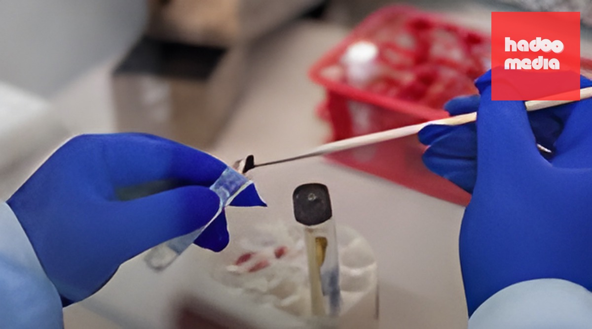 Phát hiện vi khuẩn Salmonella trong thịt gà tây tại siêu thị Lidl Plzeň