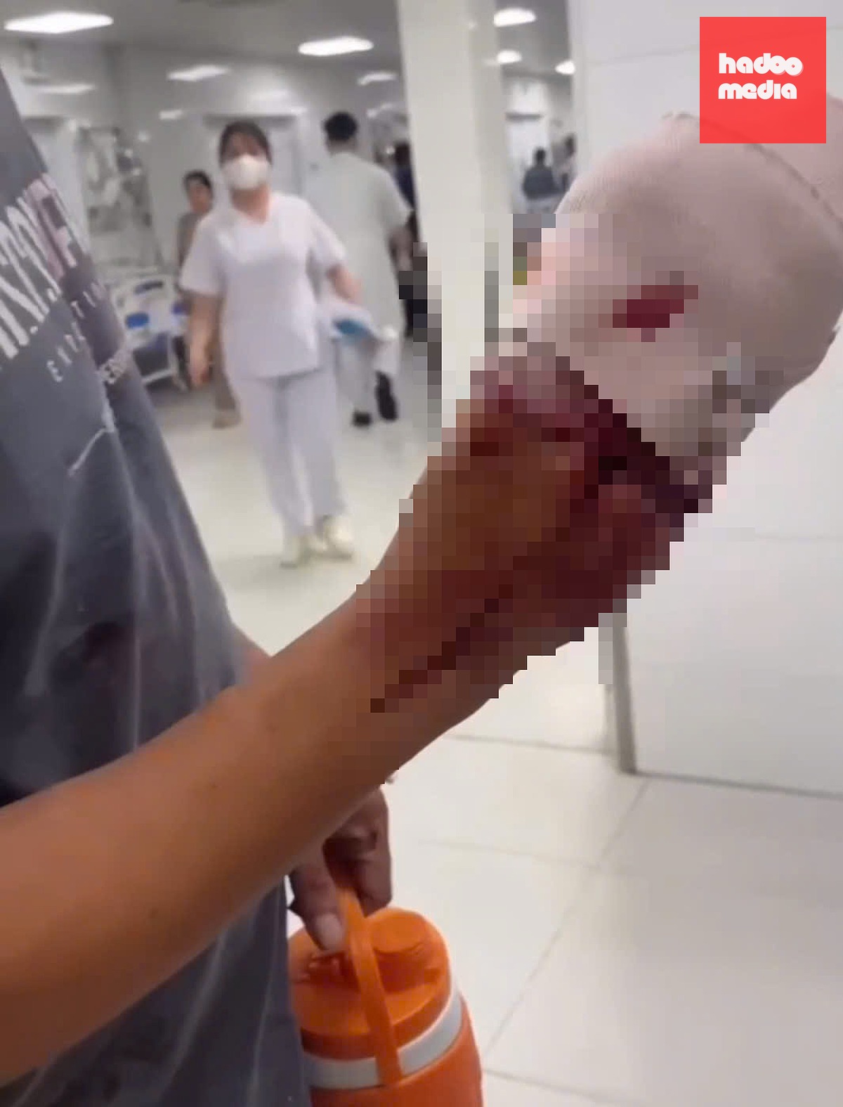 Nạn nhân đứt ngón tay được Cảnh sát giao thông TP Cần Thơ đưa đến bệnh viện cấp cứu kịp thời - Ảnh: CACC