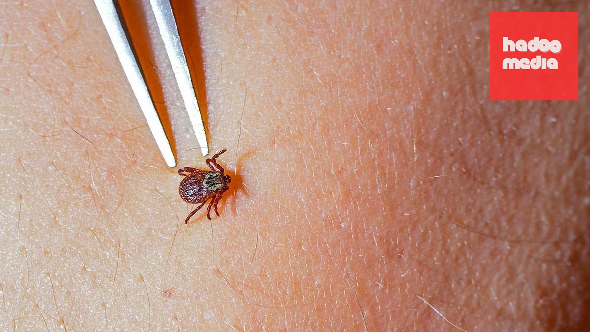 Séc Ghi Nhận Tăng Mạnh Ca Bệnh Lyme Với 90 Trường Hợp Mới Mỗi Ngày