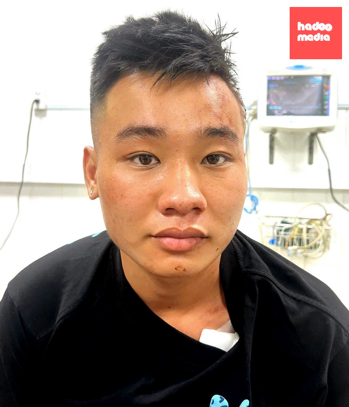 Nguyễn Đức Anh, 21 tuổi, ngụ phường Hố Nai, TP Đồng Nai, bị khởi tố, bắt tạm giam để điều tra về hành vi giết người - Ảnh: Công an Đồng Nai
