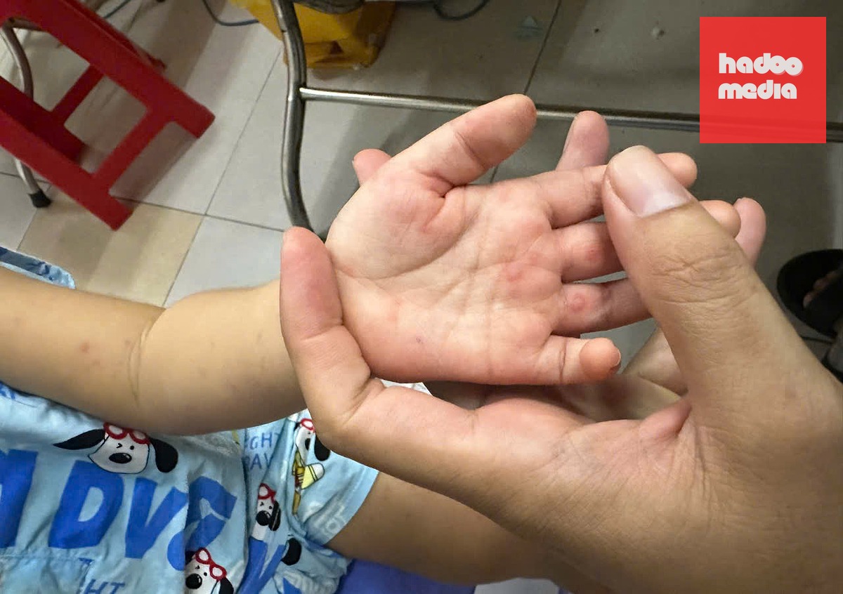 Số ca mắc sốt xuất huyết ở TP.HCM tăng nhẹ trong tuần qua - Ảnh: TTO